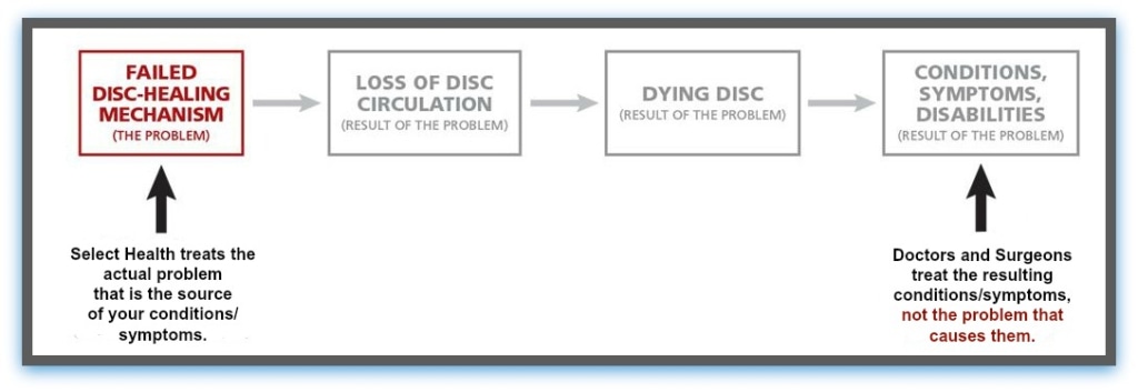 spinal disc treatment diagram