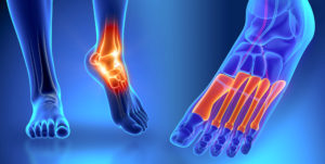 Foot and Ankle Pain