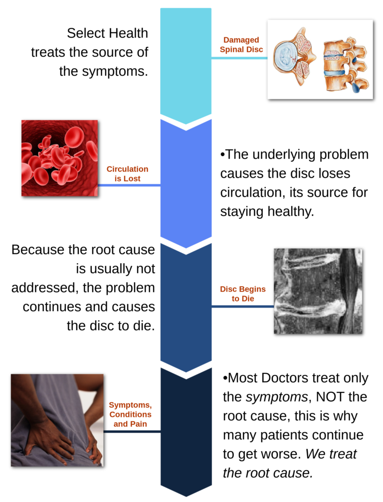 Treat the root cause of degenerative disc disease-Select Health of the Carolinas