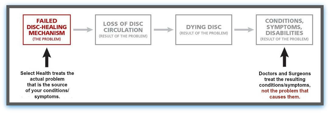 Select Health treats the root cause of disc degeneration